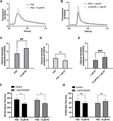 Inhibition of adenylyl cyclase 1 by ST034307 inhibits IP3-evoked changes in sino-atrial node beat rate